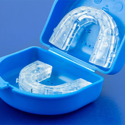 mandibular advancement splints