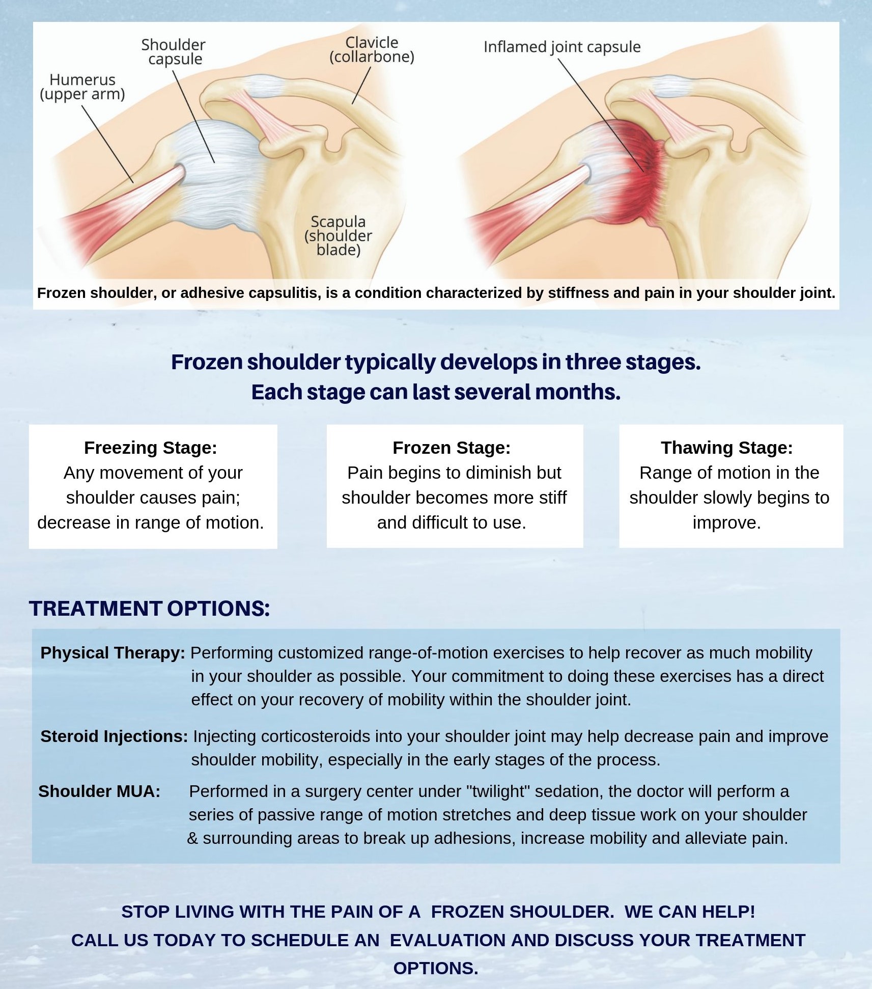 what-is-a-frozen-shoulder-pro-active