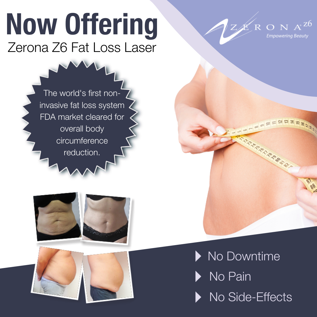 Now Offering Zerona Z6