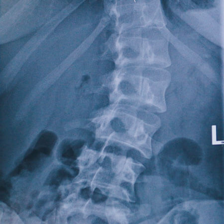 x-ray image