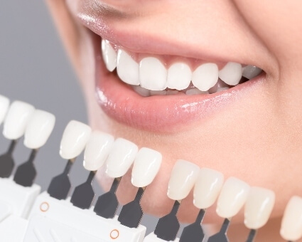 Female patient getting fitted for dental veneers