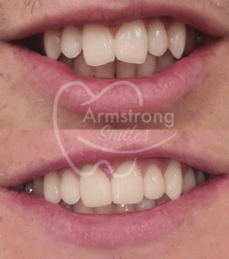 GIF-img-gallery-v1 (1)