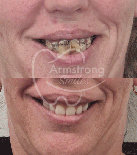 GIF-img-gallery-v2 (1)