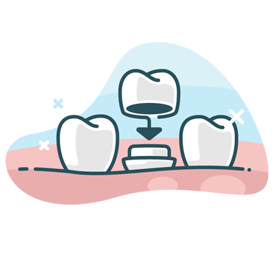 illustration of dental crowns