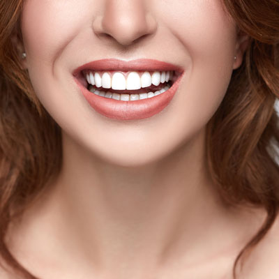 woman with a bright smile closeup