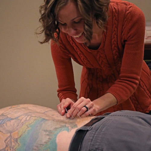 Patient treated with Acupuncture
