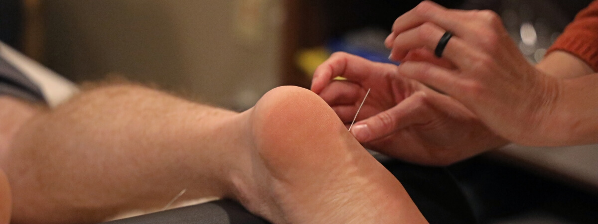 Belton patient treated with Acupuncture