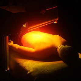 phototherapy on patients back