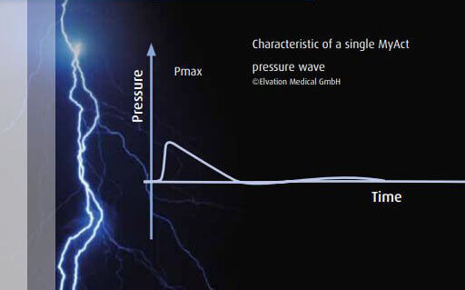 Pressure/Time Graph