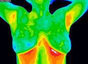 thermography-normal-image