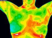 thermography-normal-image
