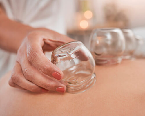 cupping on back