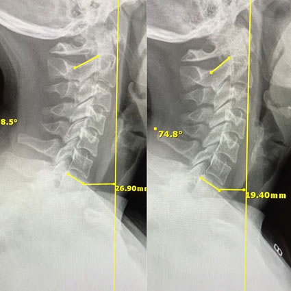 xray results