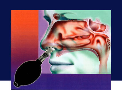 Cranial Facial Release Diagram