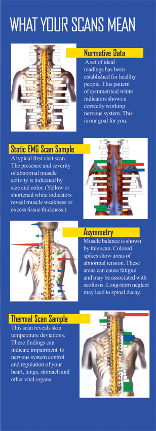 Surface emg illustration