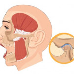 Jaw Pain