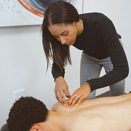 Applying acupuncture needles