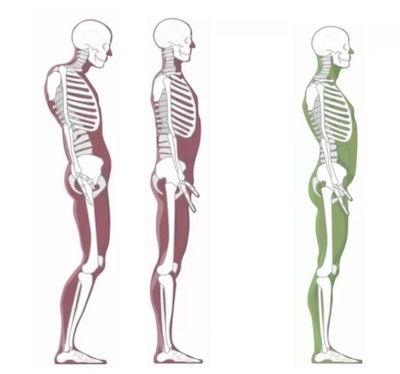 posture examples