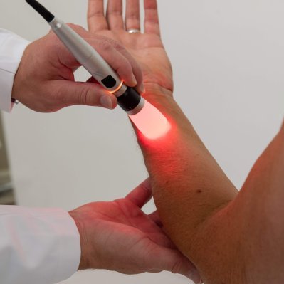 laser therapy on patients arm