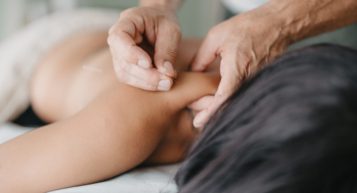 Female patient receiving dry needling treatment