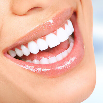 Teeth-whitening-closeup-smile