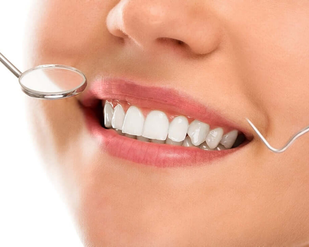 Close-up-white-smile-dental-checkup