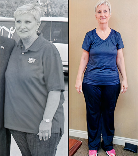 Ginette's before and after weight loss photos.