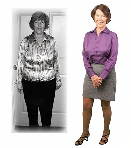 Judy's before and after photo.