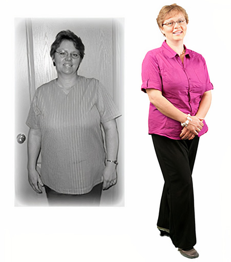 Suzanne's before and after weight loss photos.