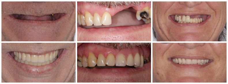 before and after