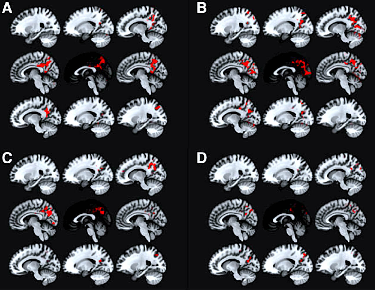 brain scan results