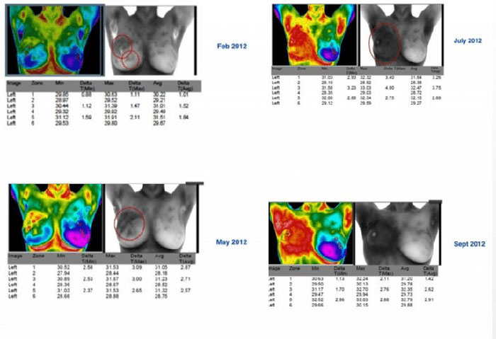 Four scans with data