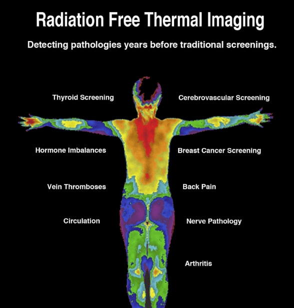 Thermal Imaging scan