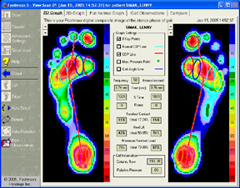 The FootMaxx dynamic software.