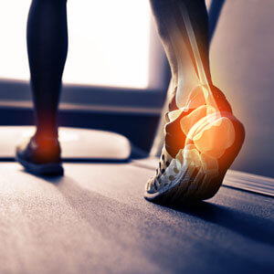 heel-pain-while-walking-sq-300