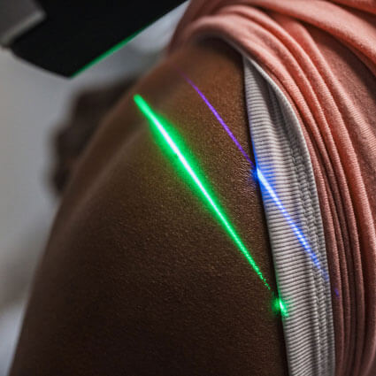 Laser therapy on shoulder