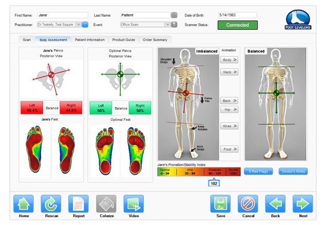 Foot Scan Results