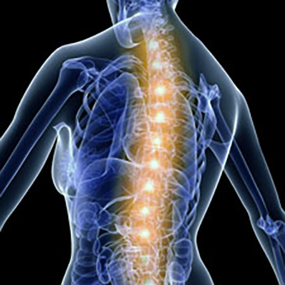 xray of spine