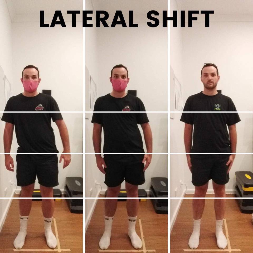 lateral shift