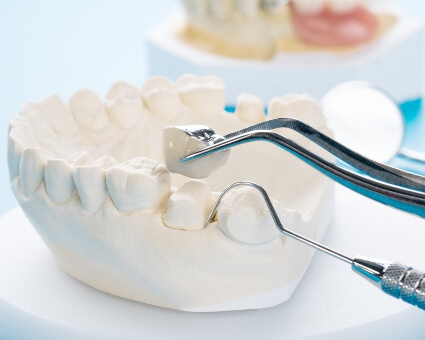 Dental crown model