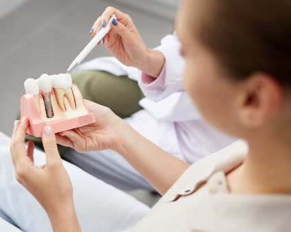 Dental Implant model