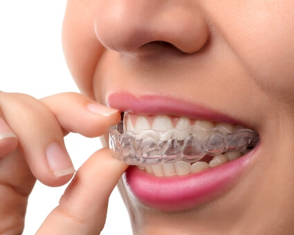 Woman fitting invisalign