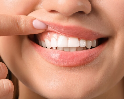 Woman showing her smile