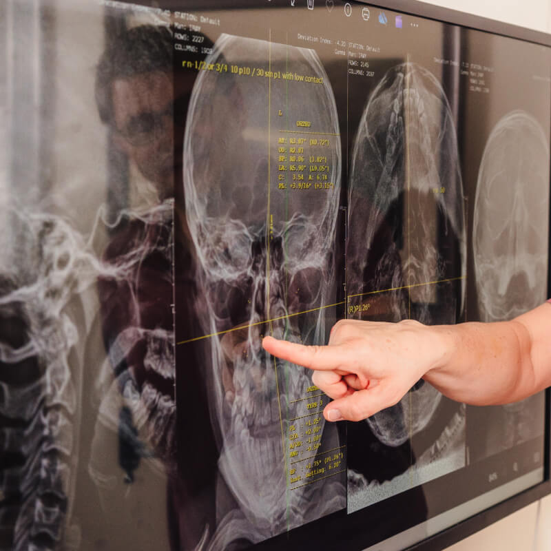 person pointing at an xray