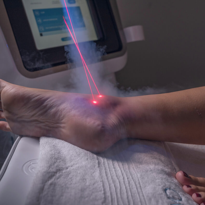 cryotherapy on persons ankle