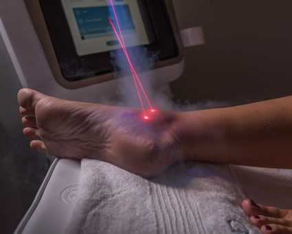 Cryotherapy on ankle