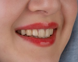 kamal-hoseinianzade-zOfNW3ZL-L8-unsplash