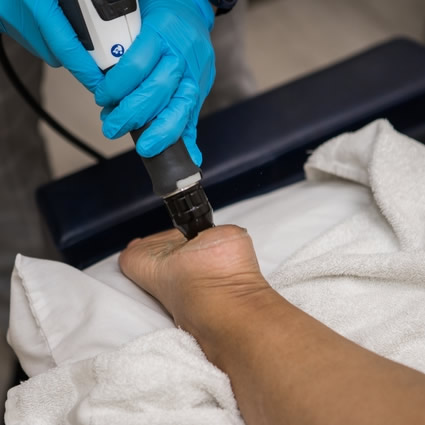 Shockwave therapy on foot
