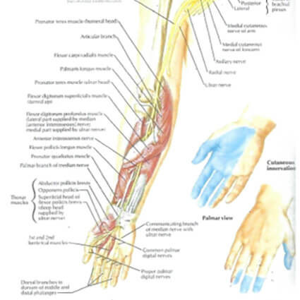 Cervical Radiculopathy chart chart