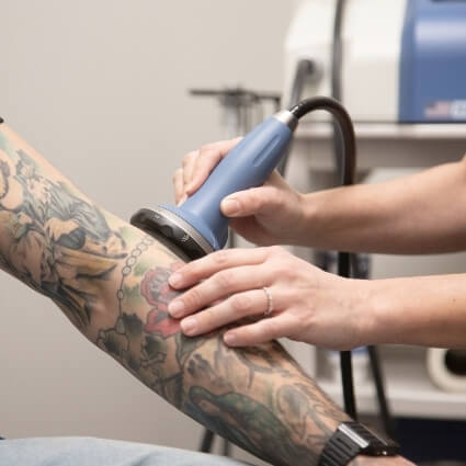 shockwave therapy on persons arm